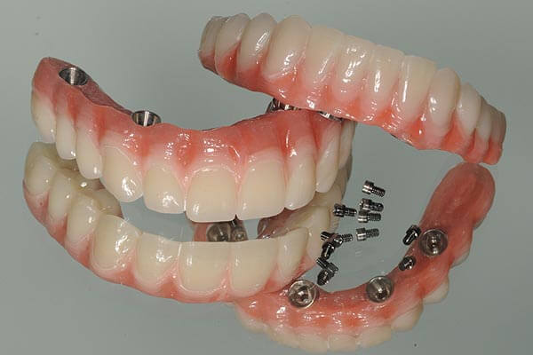 Dritten mit die 30 zähne Zahnprothese reinigen